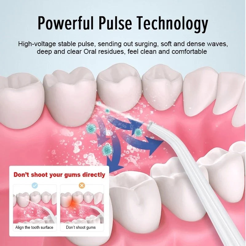 FresherBreath™ Oral Plaque Irrigator